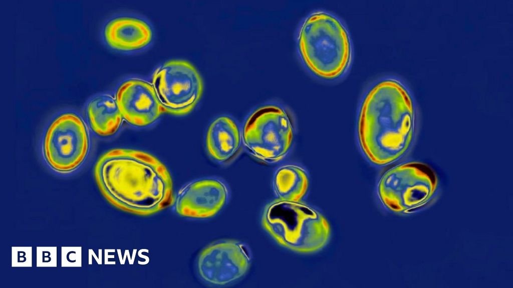Candida auris fungal infections spreading in US at 'alarming' rate, says CDC